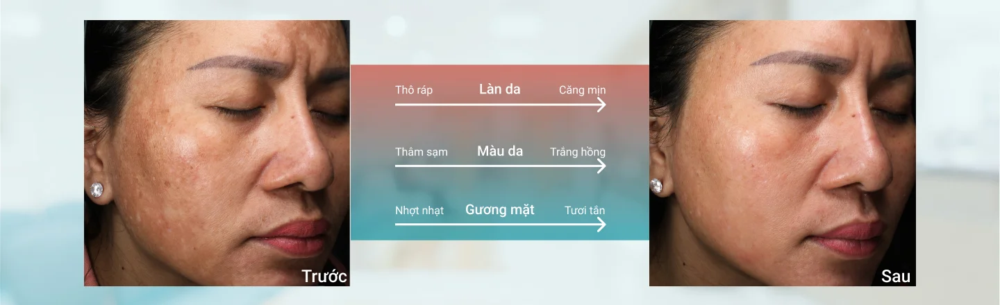 trước v&agrave; sau điều trị 